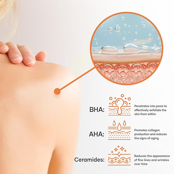 Salicylic Acid Body Wash - Skin Non-drying, Gentle Exfoliates Rough and Bumpy Skin, Body Acne Wash, BHA & AHA - Unscented Exfoliating Body Wash, Made in USA - (16 fl oz x 2)-FemmiqueWomen