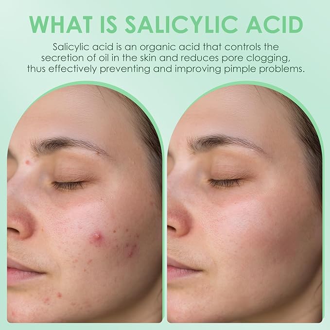 AUSLKA Salicylic Acid Oil Balancing Spray with 2% Salicylic Acid Regulates Skin Balance for Pimple and Oily Skin, Fruit Acid Spray for Face & Body (3.4 Fl Oz)-FemmiqueWomen