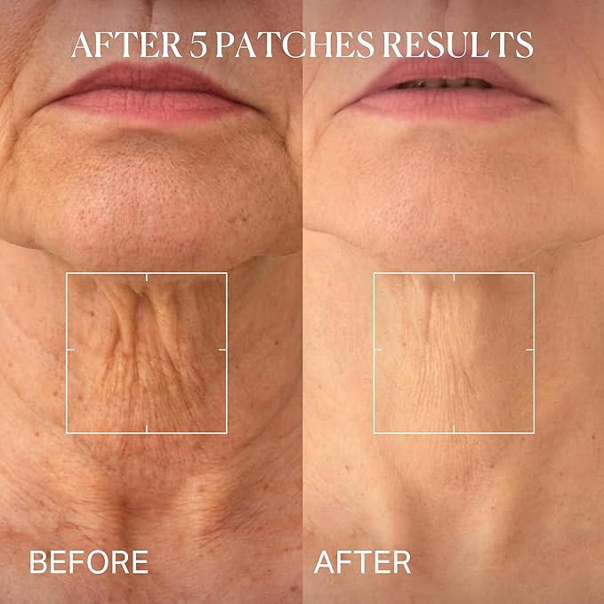 depology Tightening and Lifting Neck Wrinkle Patches with Cream, PDRN Deep Collagen Neck Mask, Firming Patch with PDRN、Collagen and Niacinamide Cream-FemmiqueWomen