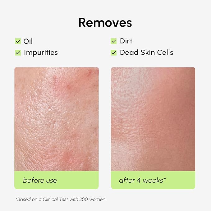 MAREE Exfoliating Toner with Salicylic Acid – AHA BHA Exfoliant & Face Exfoliator Pore Cleaner – BHA Liquid Exfoliant – Sebum Dead Skin Care Remover for Face – Exfoliante Para la Cara Acido Salicilico-FemmiqueWomen