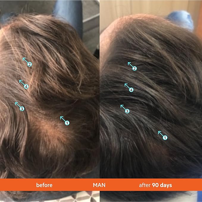 DS Labs Revita Shampoo – High-Performance Hair Density Shampoo, Volumizing & Thickening, Fuller, Healthier-Looking Hair, Sulfate & Silicone Free, For Men & Women, 205mL (Pack of 2)-FemmiqueWomen