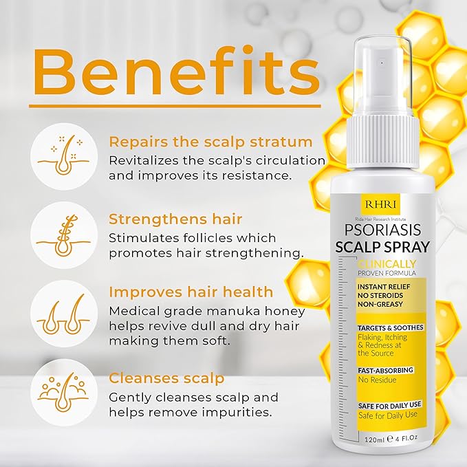 Psoriasis Scalp Spray | Psoriasis and Dandruff Treatment for Scalp Yeast Infections, Psoriasis Flare-Ups & Folliculitis | Antifungal Ringworm Itchy Scalp Spray for Psoriasis, Dryness-FemmiqueWomen