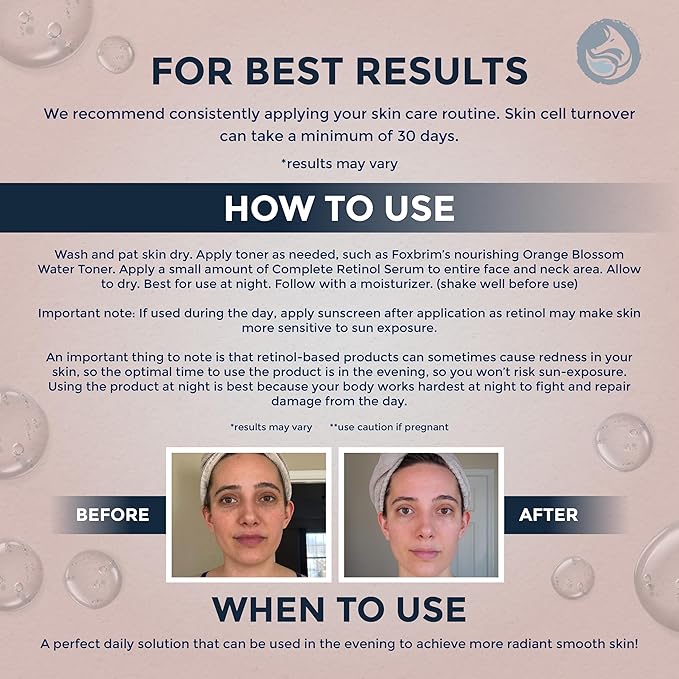 Retinol Face Serum - 3% Retinol - Anti Aging Night Serum - with Gotu Kola, Hyaluronic Acid, Horsetail Extract & Organic Jojoba Oil - 1oz by Foxbrim Naturals-FemmiqueWomen