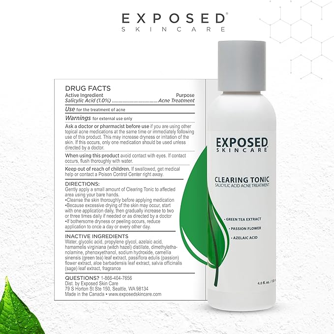 Exposed Skin Care Clearing Tonic Facial Toner with 1% Salicylic Acid and Witch Hazel for Acne Treatment – Pore Minimizing Toner to Prevent Breakouts, Reduce Redness and Balance Skin – Step 2 (4 fl oz)-FemmiqueWomen