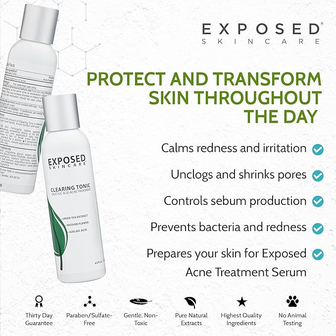 Exposed Skin Care Clearing Tonic Facial Toner with 1% Salicylic Acid and Witch Hazel for Acne Treatment – Pore Minimizing Toner to Prevent Breakouts, Reduce Redness and Balance Skin – Step 2 (4 fl oz)-FemmiqueWomen