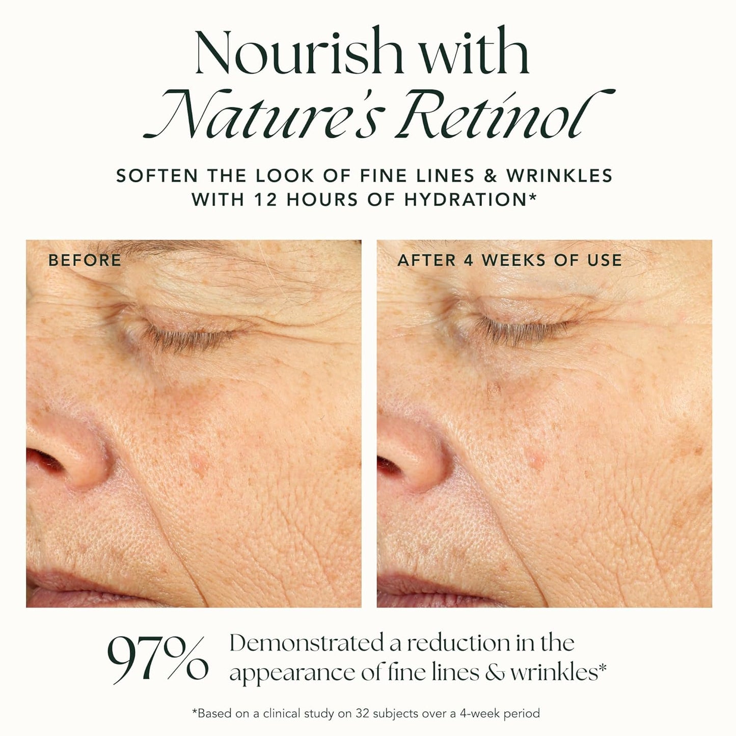 RANAVAT Renewing Bakuchi Face Cream - Daily Face Moisturizer with 12 Hour Hydration to Boost Skin Barrier Function - Softens Fine Lines + Wrinkles with Lotus Flower, Bakuchi & Ashwagandha (1.7 oz)-FemmiqueWomen