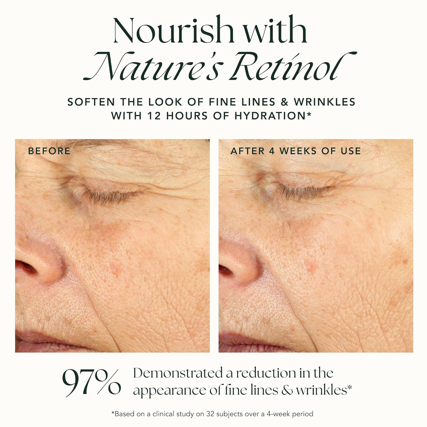 RANAVAT Renewing Bakuchi Face Cream - Daily Face Moisturizer with 12 Hour Hydration to Boost Skin Barrier Function - Softens Fine Lines + Wrinkles with Lotus Flower, Bakuchi & Ashwagandha (1.7 oz)-FemmiqueWomen