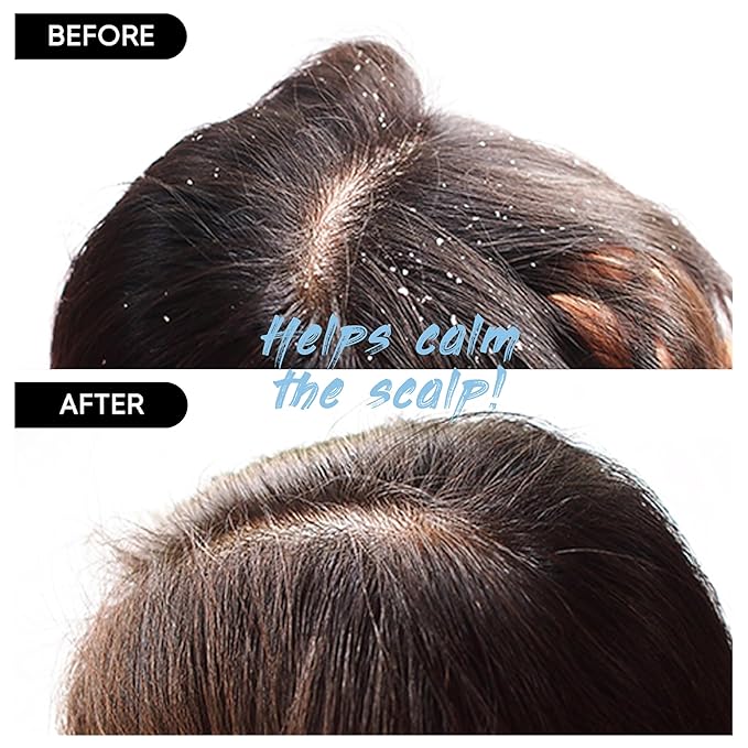 Red Bean Shampoo Bar 2.0 - Hydrating & Moisturizing Natural Hair Soap Bar Shampoo for Hair Color & Scalp Nourishment - Bathing Soap Solid Shampoo for All Hair Types (120g, 4.23oz)-FemmiqueWomen