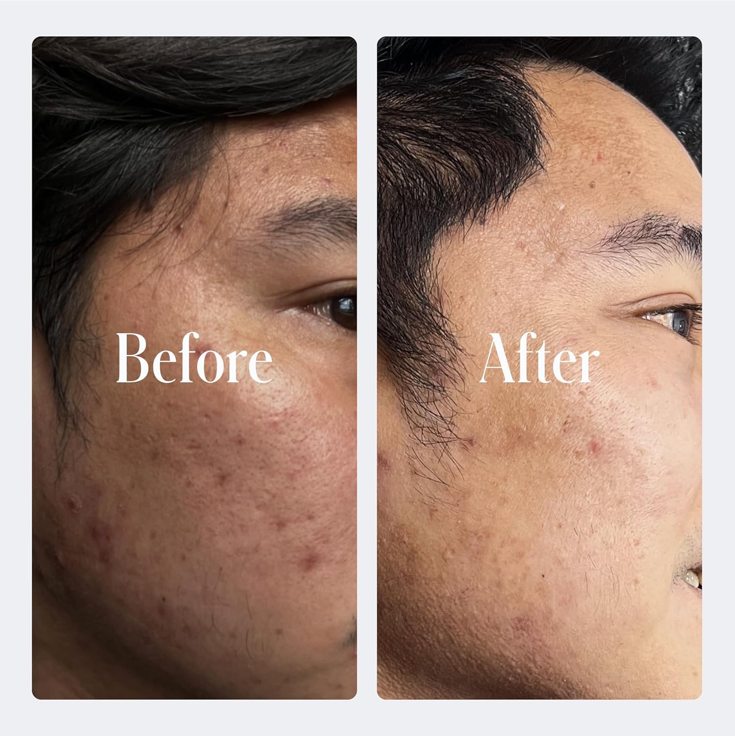 Geologie Retinol Anti-Aging Face Cream | Advanced .3% Retinol Formula for Effective Results | Reduce Fine Lines & Wrinkles | Protect & Repair Skin With Hyaluronic Acid & Niacinamide | For Men & Women-FemmiqueWomen