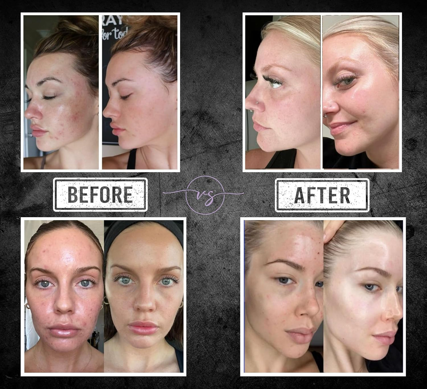 Luxurious Skincare Bar - The Only Sleep-Enhancing Premium Soap with Encapsulated Melatonin, Essential Oils & 40+ Ingredients - All-in-One Face & Body Evening Ritual - Large Block Format (10.6 oz)-FemmiqueWomen