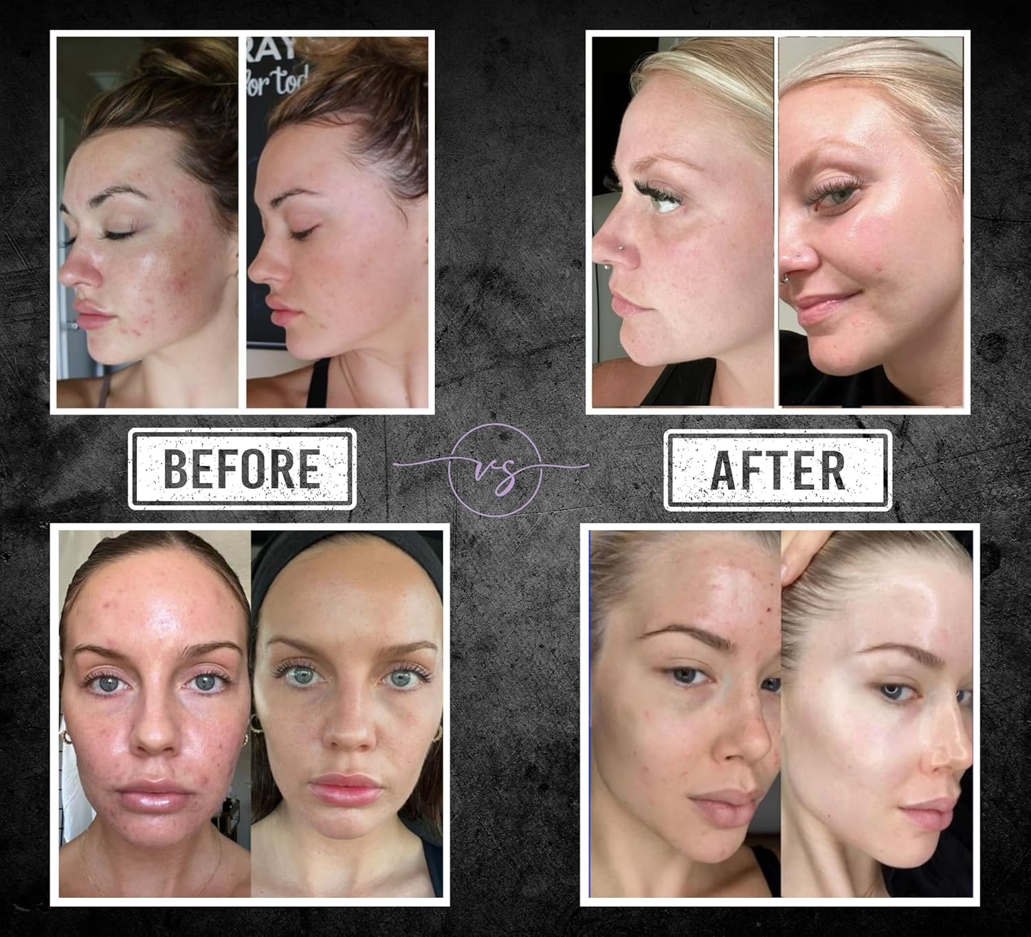 Luxurious Skincare Bar - The Only Sleep-Enhancing Premium Soap with Encapsulated Melatonin, Essential Oils & 40+ Ingredients - All-in-One Face & Body Evening Ritual - Large Block Format (10.6 oz)-FemmiqueWomen