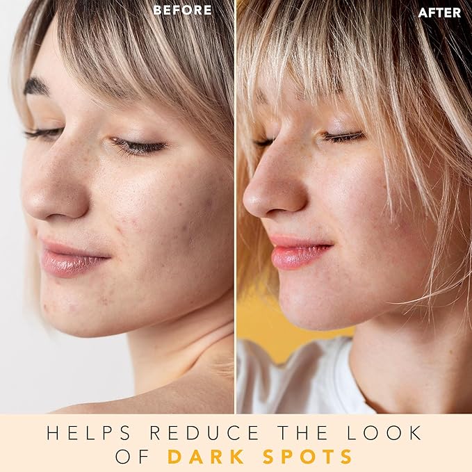 Vitamin C Face Toner - USA Made with Natural & Organic Ingredients, Alcohol-Free Skin Brightening Facial Toner for Sensitive and Aging Skin, Pore Minimizing Face Mist for Women and Men-FemmiqueWomen