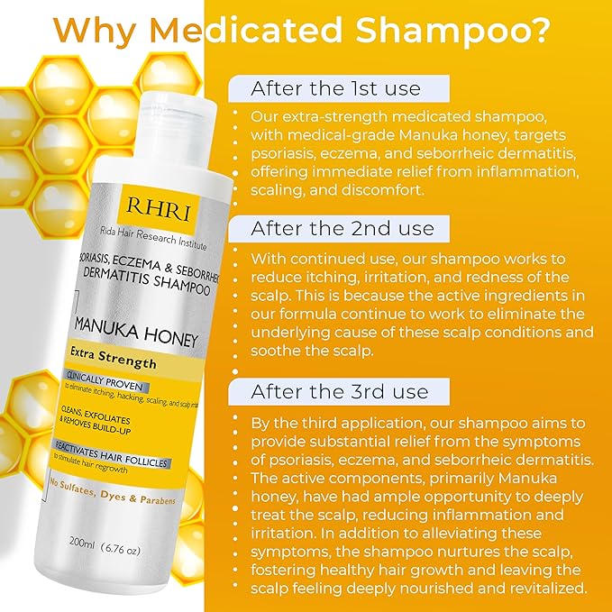 Psoriasis Shampoo for Men & Women | Itchy Scalp Treatment with Manuka Honey | Best for Eczema, Seborrheic Dermatitis, Ringworm & Folliculitis Scalp Treatment-FemmiqueWomen
