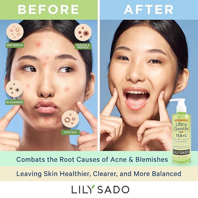 LILY SADO TEA+C™ Green Tea & Vitamin C Face Cleanser – Natural Vegan Antioxidant Daily Face Wash with Aloe, Rosehip, Meadowfoam - Gentle Deep Cleansing for Acne, Blackheads, Blemishes. 8 oz-FemmiqueWomen