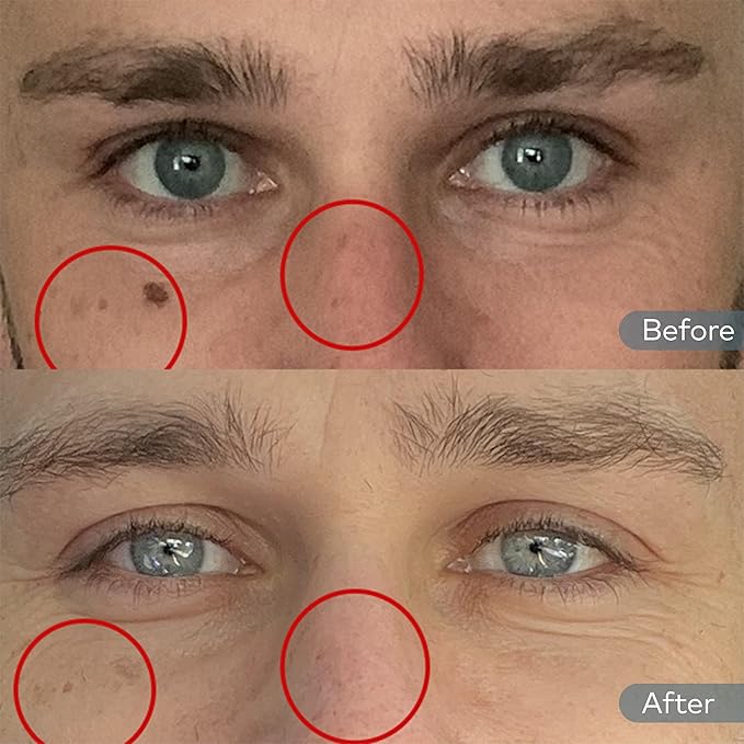 Onekind Dream Cream Night Moisturizer – Hydrating Anti-Aging Face Cream with Squalane, Rosehip & Shea Butter – Fragrance-Free, Vegan, for Dry & Sensitive Skin – 1.7 oz-FemmiqueWomen