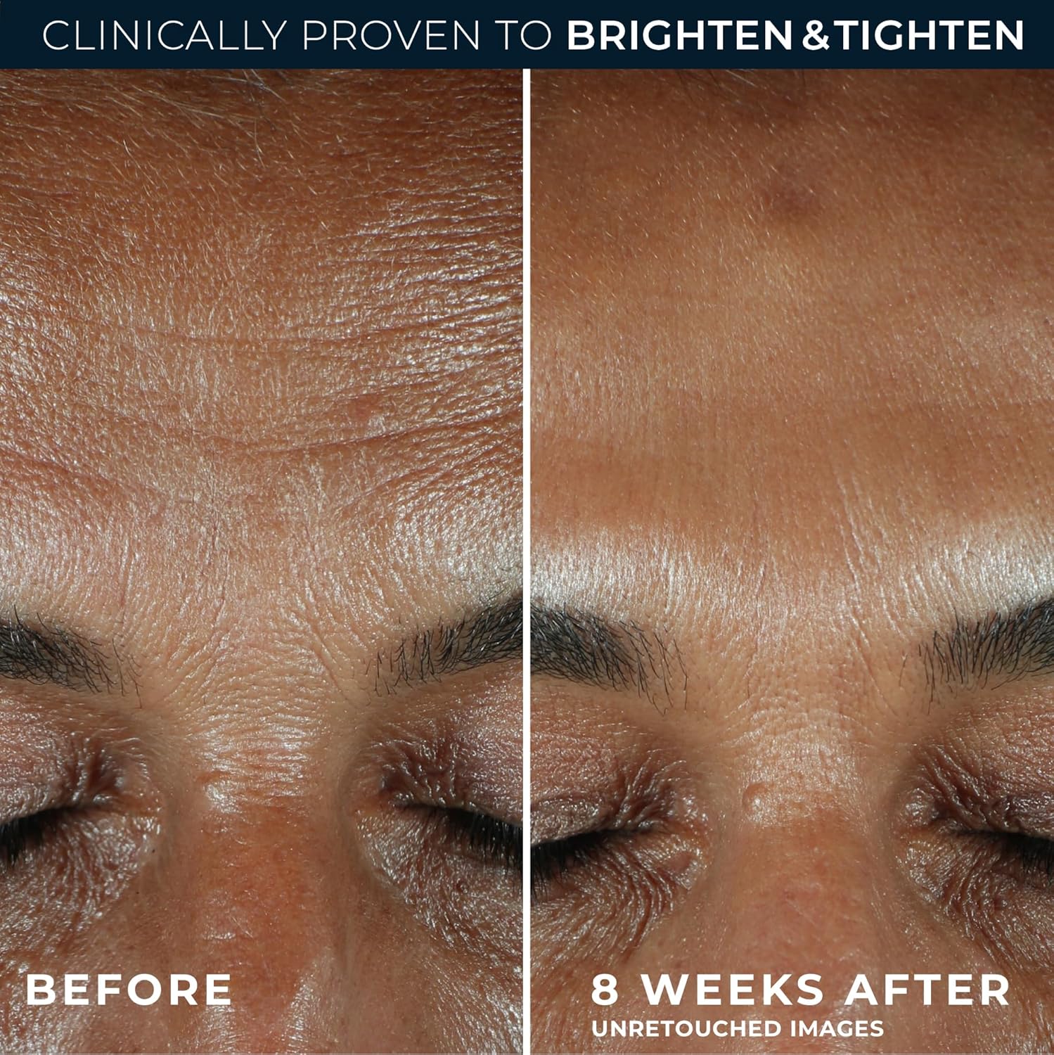 RoC Multi Correxion Revive + Glow 10% Active Vitamin C Serum for Face, Daily Anti-Aging Wrinkle and Skin Tone Skin Care Treatment, Brightening Serum , 1 Fluid Ounce-FemmiqueWomen