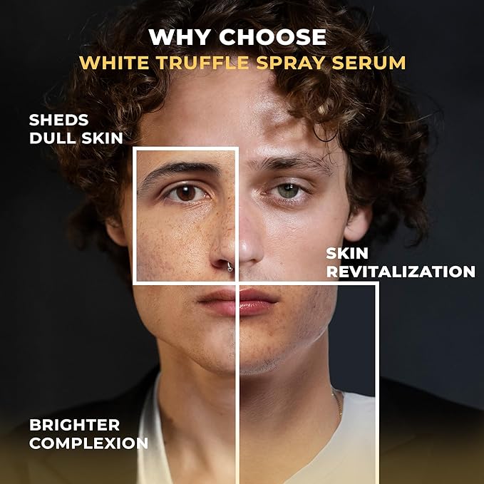 Italian White Truffle Spray Serum - Vegan Skin Care - Face Mist Hydrating Spray with Avocado & White Truffles - Face Serum for Radiant Skin - 3.38 Fl Oz-FemmiqueWomen