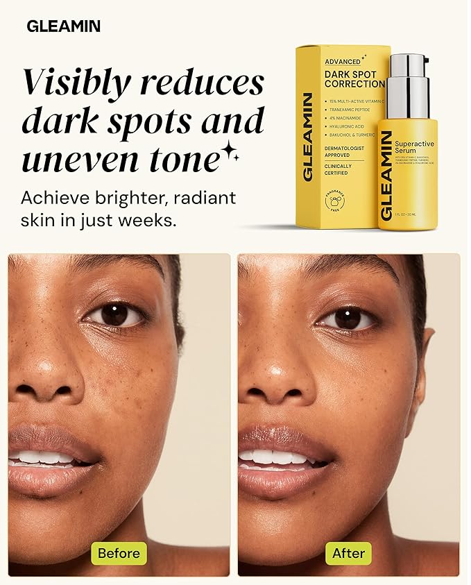 Gleamin Superactive Vitamin C Serum for Face with 15% Vitamin C, Niacinamide, Bakuchiol & Hyaluronic Acid – Skin Brightening Facial Serum for Women & Men – Dark Spot Remover & Radiant Glow – 1 fl oz-FemmiqueWomen