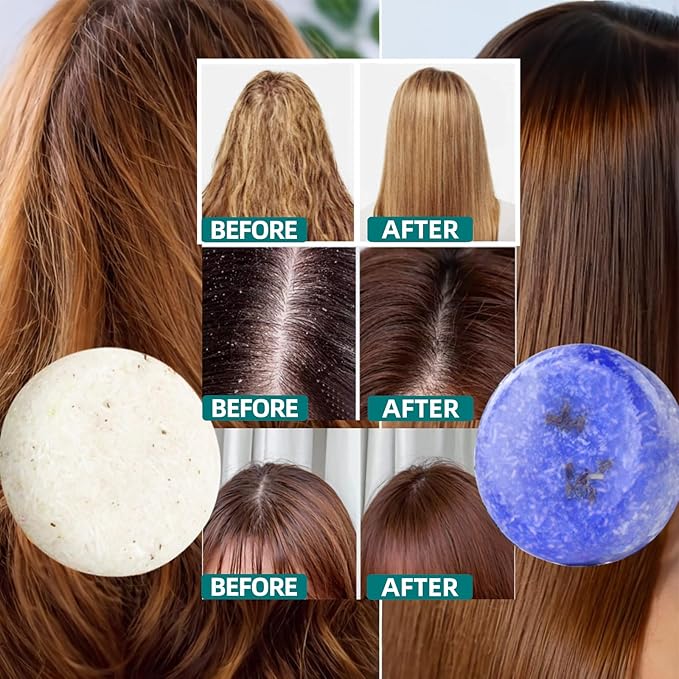 2 Pack Rosemary Lavender Hair Shampoo Bar,Deep Cleansing for Scalp Hair Loss Shampoo Soap,Organic Shampoo Oil Control for Hair Growth,Refreshing and Hydrating Bar,Gifts for Women Men-FemmiqueWomen