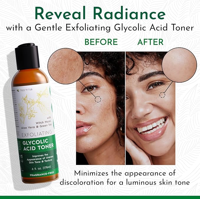 Tree To Tub Glycolic Acid Toner for Face w/Witch Hazel & Hydrating Aloe Vera for Smooth Skin - Minimizes Appearance of Fine Lines & Brightens - Vegan Exfoliating Toner for Women & Men-FemmiqueWomen