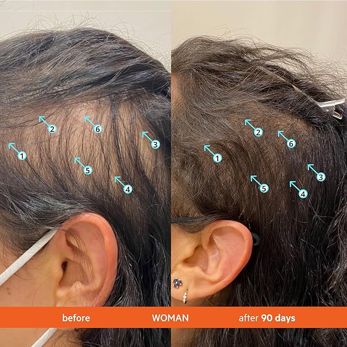 DS Labs Revita Shampoo Travel Size – High-Performance Hair Density Shampoo, Volumizing & Thickening, Fuller, Healthier-Looking Hair, Sulfate & Silicone Free, For Men & Women, 100mL-FemmiqueWomen