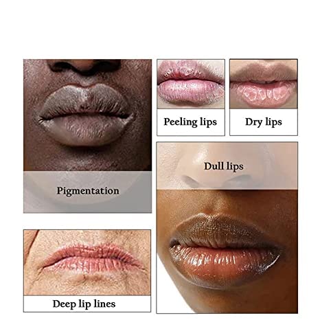 2pcs Lip Lightening for Dark Lips Lip Brightener for Smokers Dark Lip Treatment Lightening Cream for Pink Lips Lip Lightener for Smoker Lips Lip Lightening balm for Men and Women (Red)-FemmiqueWomen