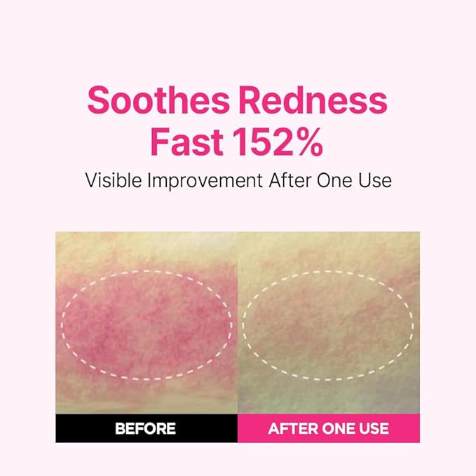 ISOI Blemish Care Up Serum for Face, Vegan Hydrating Serum for Smooth & Glass Skin Effect, Skin Barrier & Moisture Balance for Women, Korean Skin Care (0.85 fl. oz, 25ml)-FemmiqueWomen