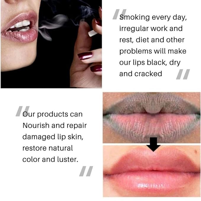 2PC Lip Balm Fade Dark Pigment Whitening Moisturizing Lip Hyaluronic Acid Exfoliating Dead Skin Lightening Lip Care (Red)-FemmiqueWomen