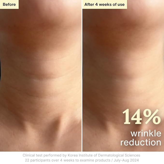 Rothea Resilience Cream, Anti-Aging with Bakuchiol 10,000ppm (Natural Retinol Alternative), Face Moisturizer, Neck Cream with Collagen, Ceramides, Peptides, Niacinamide, Korean Skin Care, 1.7 oz-FemmiqueWomen