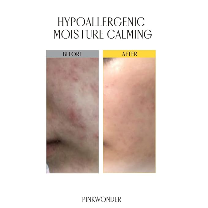 PINKWONDER Tamanu Hero Calming Gel 5.07oz (150ml) | Organic Tamanu Gel, Cooling, Soothing Instant Relief for Skin & Sunburn, Sunburn Relief, Alcohol Free, Gel cream, Korean Skincare-FemmiqueWomen