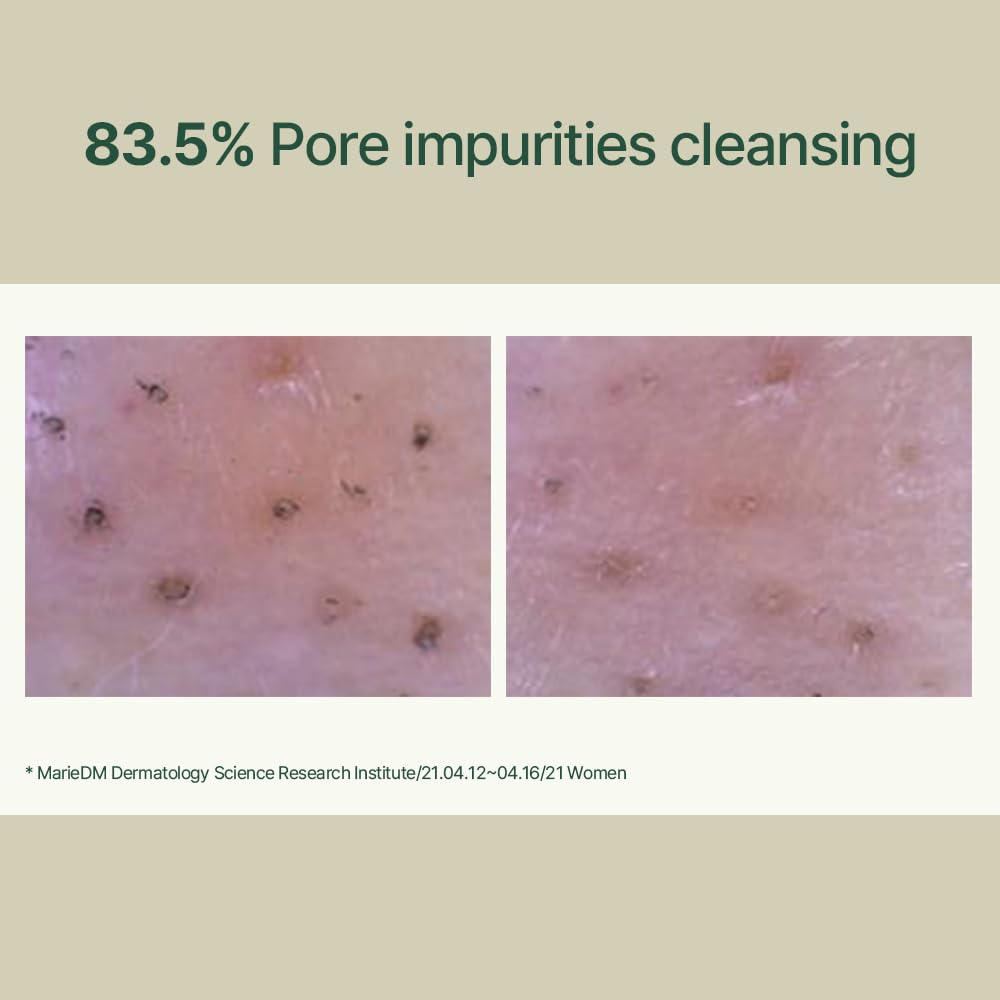 Pyunkang Yul PKY Calming Low pH Foaming Cleanser | Daily Face Wash & Makeup Remover with Tea Tree, Centella Asiatica, 5 Hyaluronic Acids that Removes Dead Skin Cells, Hydrates Skin - 150ml 5.07 Fl.Oz.-FemmiqueWomen