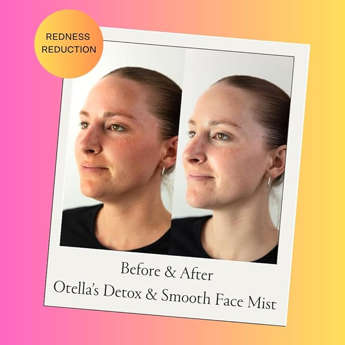 Detox & Soothe Face Mist with Hypochlorous Acid | Reduces Redness & Breakouts | pH Balance & Skin Cleansing for Active Lifestyles | TSA Approved, 2.7 oz | Clean Ingredients-FemmiqueWomen