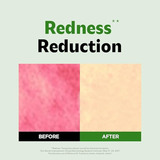 ISOI Moisture Dr. Soothing Cream, Deep Hydration & Barrier Support with Hyaluronic Acid, Lightweight Moisturizer for Sensitive Types, Korean Skin Care (2.37 fl.oz, 70ml)-FemmiqueWomen