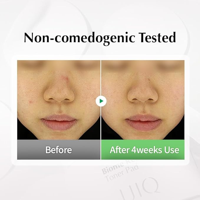 UIQ Biome Remedy Toner Pads, Dual-Textured Facial Pad for Hydrating, Moisturizing, Calming, Pore Care, Non Comedogenic, Daily Toner Pads for Soothing Skin 6.08 fl. oz., 70 Sheets-FemmiqueWomen