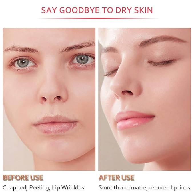 20Pcs Moisturizing Restores Moisture Lip Mask for Dry Lips and Lip Lines Overnight Lip Care, Gel Treatment Plumping Lips Mask (Red)-FemmiqueWomen