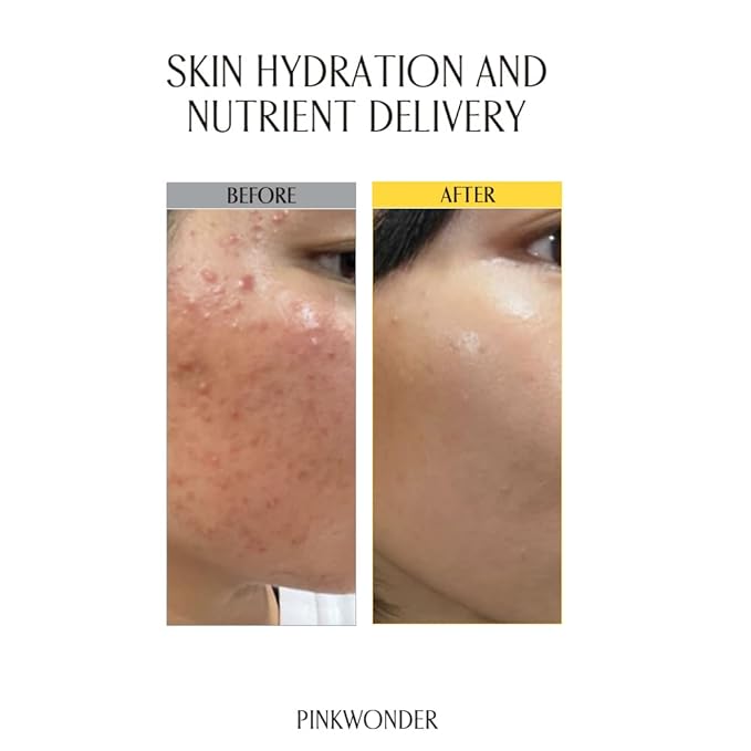 PINKWONDER USDA Organic Jojoba Oil (6.76oz, Jojoba Toner)-FemmiqueWomen