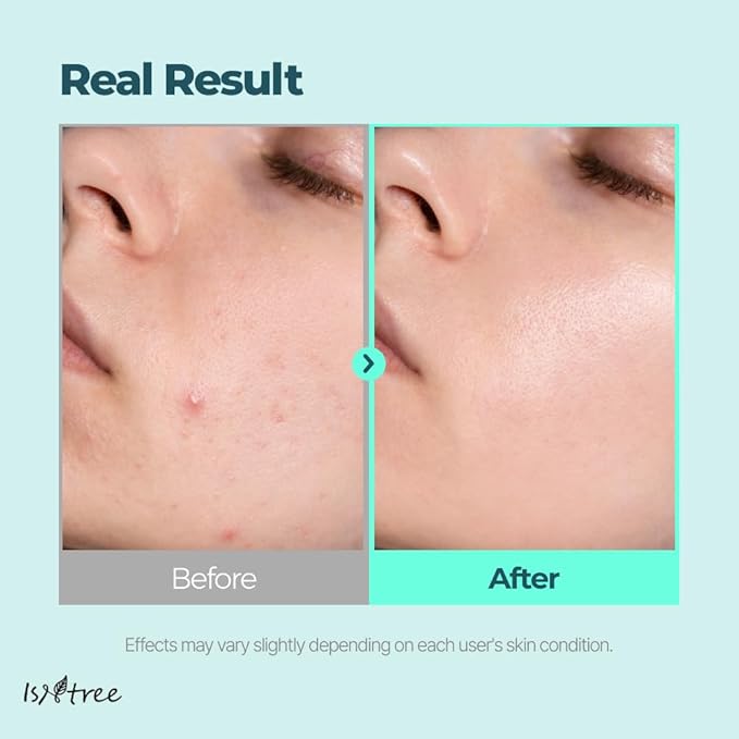 IsNtree Gim PDRN Deep Sleep Mask 80ml, 2.7 fl oz | Korean SEAWEED Skincare Sleeping Mask gel | Night Cream | Facial Mask | Overnight Gel mask for Hydration & Skin Bounce-FemmiqueWomen