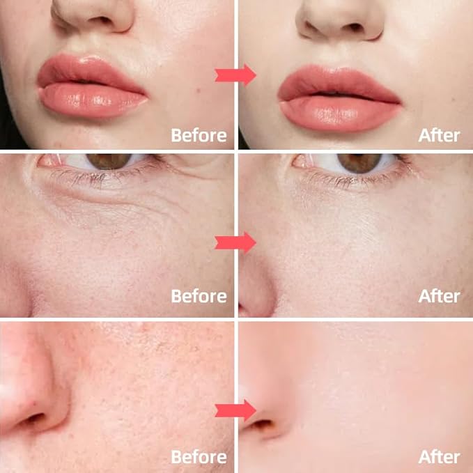 Retinol & Collagen Face Cream – Anti-Aging Moisturizer for Wrinkles & Fine Lines | Hyaluronic Acid & Peptides | Hydrates & Restores Skin Elasticity-FemmiqueWomen