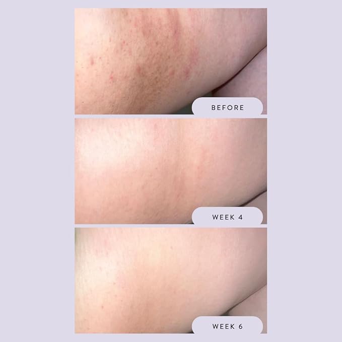 Megababe Night Rescue | Brightening & Soothing | 2.12 oz-FemmiqueWomen