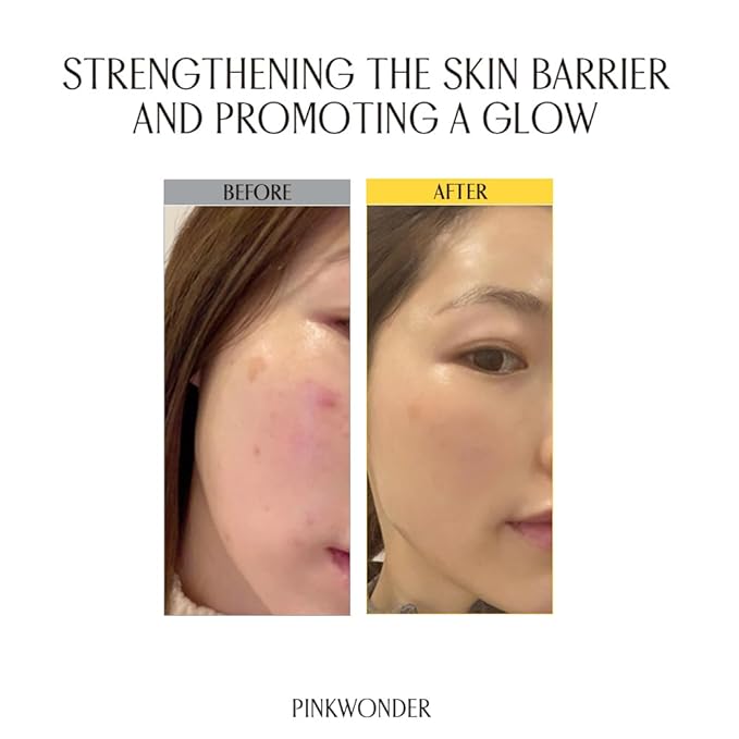 PINKWONDER Jojoba Vita Cream 3.38oz (100ml), Jojoba Oil and vitamin B12 Face Cream, Soothing for Sensitive Skin, Hypoallergenic, Korean Skincare-FemmiqueWomen