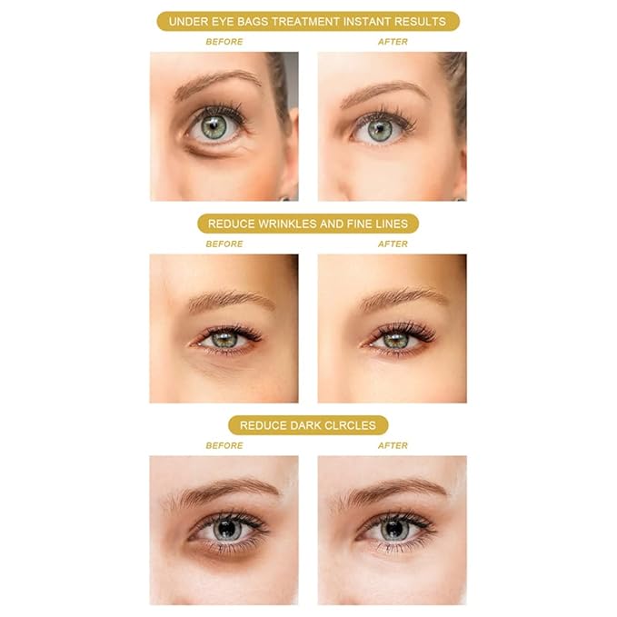 120PCS Under Eye Patches 24K Gold Eye Mask with Aloe Vera Natural Ingredients, Moisturizing Skin Care with Hyaluronic Acid and Collagen for Anti-Wrinkle, for Dark Circles and Puffiness-FemmiqueWomen