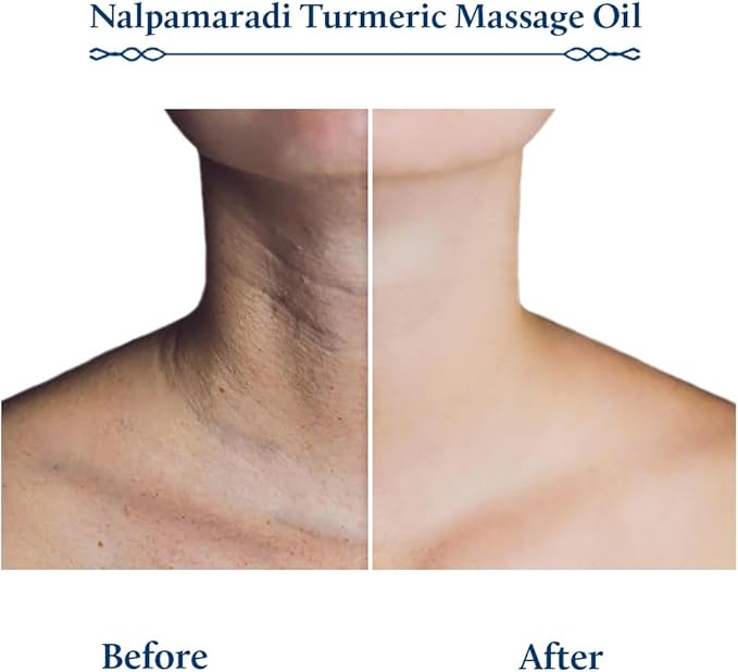 Blue Nectar Nalpamaradi Tailam Skin Radiance Oil with Turmeric | Plant Based Body Oil and Face Oil Infused with Turmeric, Amla and Manjistha (16 Herbs, 3.38 Fl Oz)-FemmiqueWomen