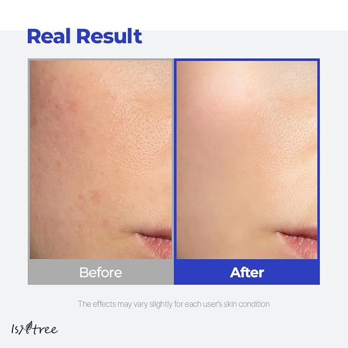 IsNtree Hyaluronic Acid Aqua Gel Cream 100ml, 3.38 fl oz | Korean Skincare | Lightweight Moisturizer | Quick-Absorbing Hydration | For Oily to Combination Skin-FemmiqueWomen