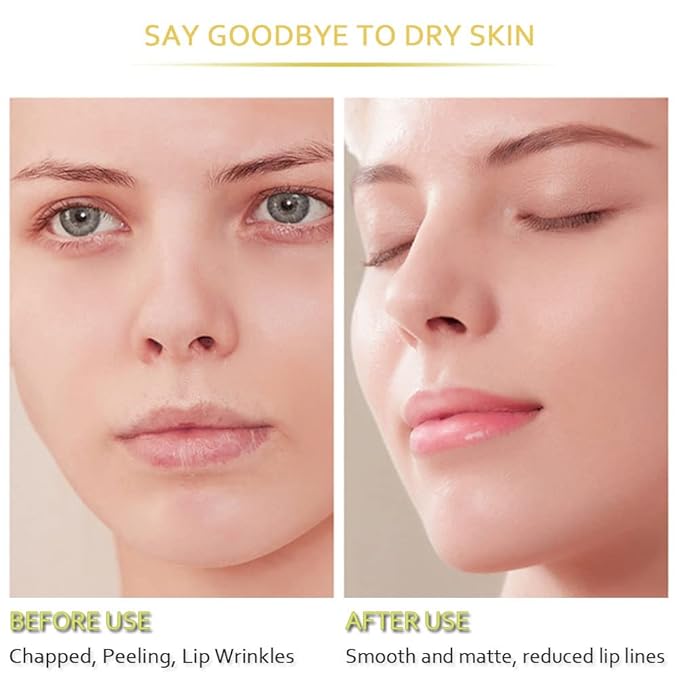 20Pcs Moisturizing Lip Mask, Restores Moisture Lip Care Mask for Dry Lips and Lip Lines Lips Overnight Lip Care, Gel Treatment Lip Masks Plumping Lips Mask (Yellow)-FemmiqueWomen