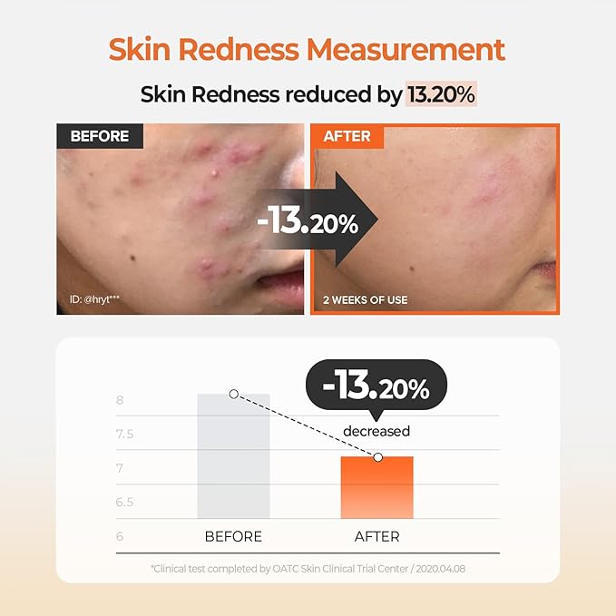 SKINFOOD Carrot Carotene Calming Water Toner Pads, Korean Skin Care Toner Pad for Face, Deep Hydrating, Soothing, After Sun Skincare for Sensitive Skin, Redness Relief, 100% Cotton, 8.81 oz (60 Pads)-FemmiqueWomen