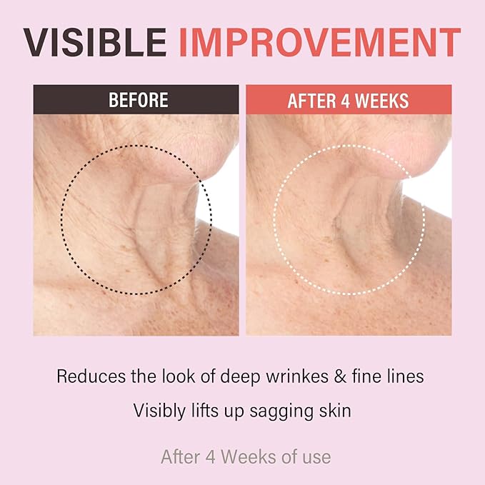 Retinol Collagen Lifting Neck Cream,Anti Aging Face and Neck Cream for Reduce Wrinkles and Hydrating & Lifting Neck,For Face, Neck, Décolleté Wrinkle Care, 1.76 oz.-FemmiqueWomen