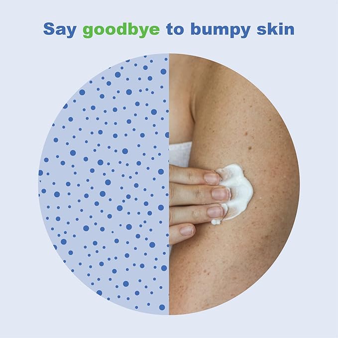 KP Elements Keratosis Pilaris Lotion (4 fl oz) - Natural Keratosis Pilaris Treatment, Moisturizing & Exfoliating AHA Lotion for KP, Vegan, Made in USA-FemmiqueWomen