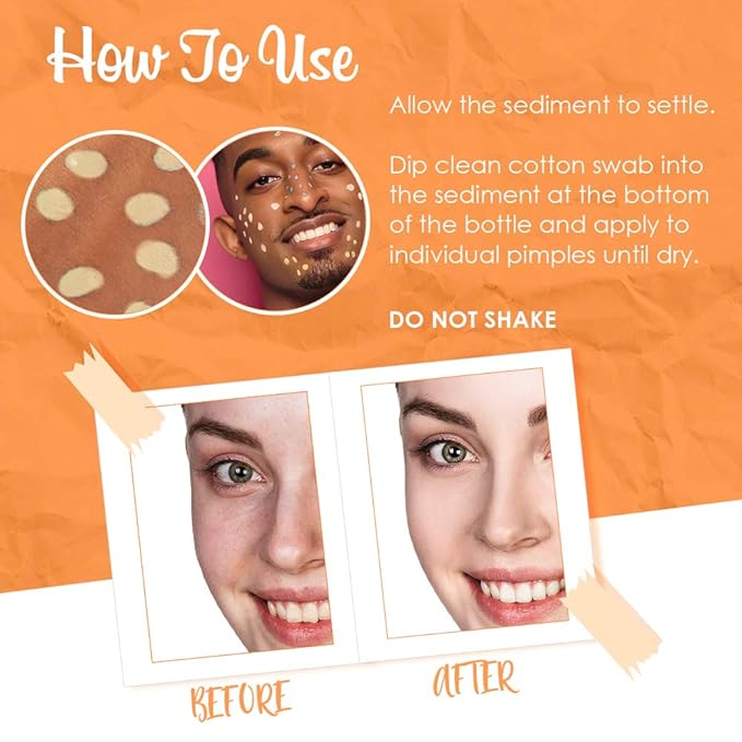 Bye Bye Blemish Dark Spot Lotion Vitamin C | Assists with Drying Blemishes And Brightening Skin | Fast Acting Solution | 1 Fl. Oz.-FemmiqueWomen