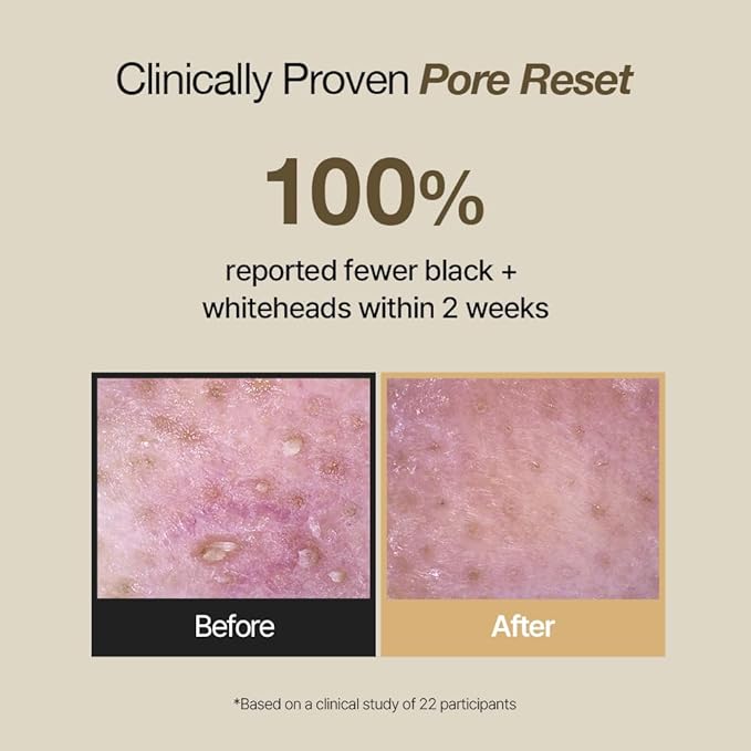 NDP Rice Mochi Deep Face Wash – Triple-Rice Airy Micro-Exfoliating Foam for Sensitive Skin, Phyto Mucin Hydration Shield, pH 5.5 Barrier-Safe Vegan Korean Skincare Cleanser, 4.05 fl oz (120 ml)-FemmiqueWomen