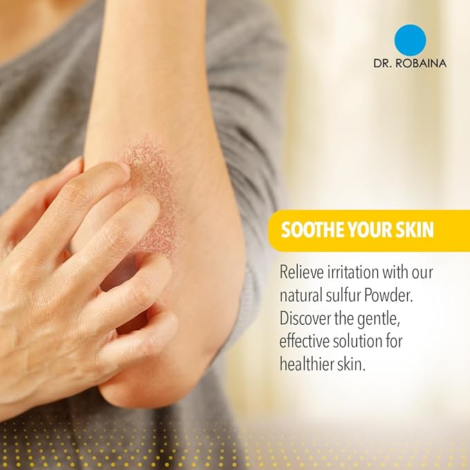 Dr. Robaina Sulfur Balsam Lotion – Lightweight Moisturizer for Dry, Flaky & Itchy Skin – Calms Redness, Supports Skin Barrier & Locks Hydration – Shea Butter & Tea Tree – 8 fl oz, USA Made-FemmiqueWomen